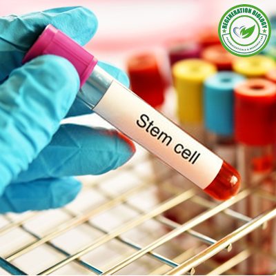 RFP Human Adipose Derived Mesenchymal Stem Cells