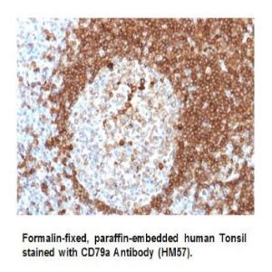 Anti-CD79A Mouse Monoclonal Antibody