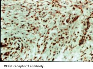Anti-FLT1 Rabbit Polyclonal Antibody