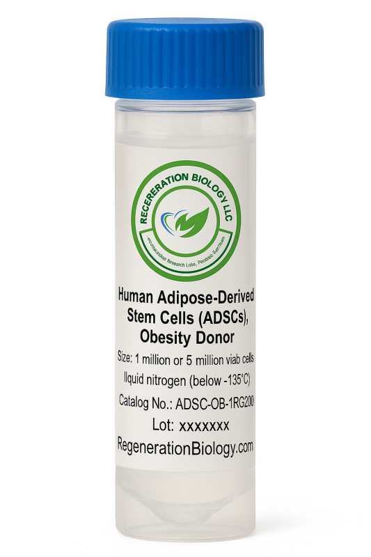 Human Adipose Derived Stem Cells (ADSCs), Obesity Donor