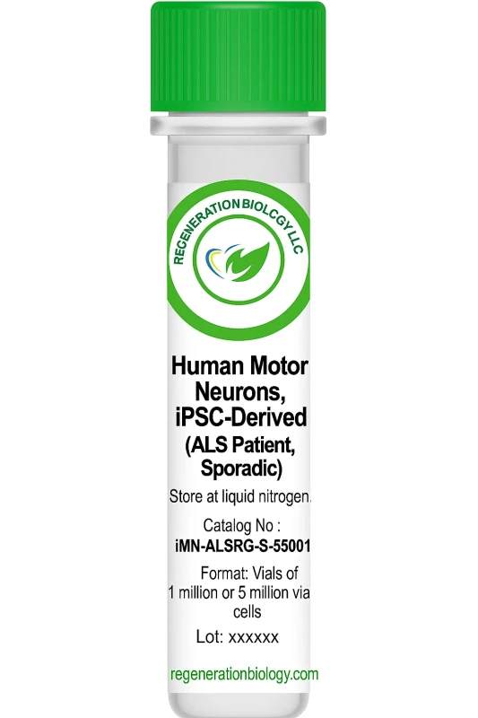 Human Motor Neurons, iPSC-Derived (ALS Patient, Sporadic)