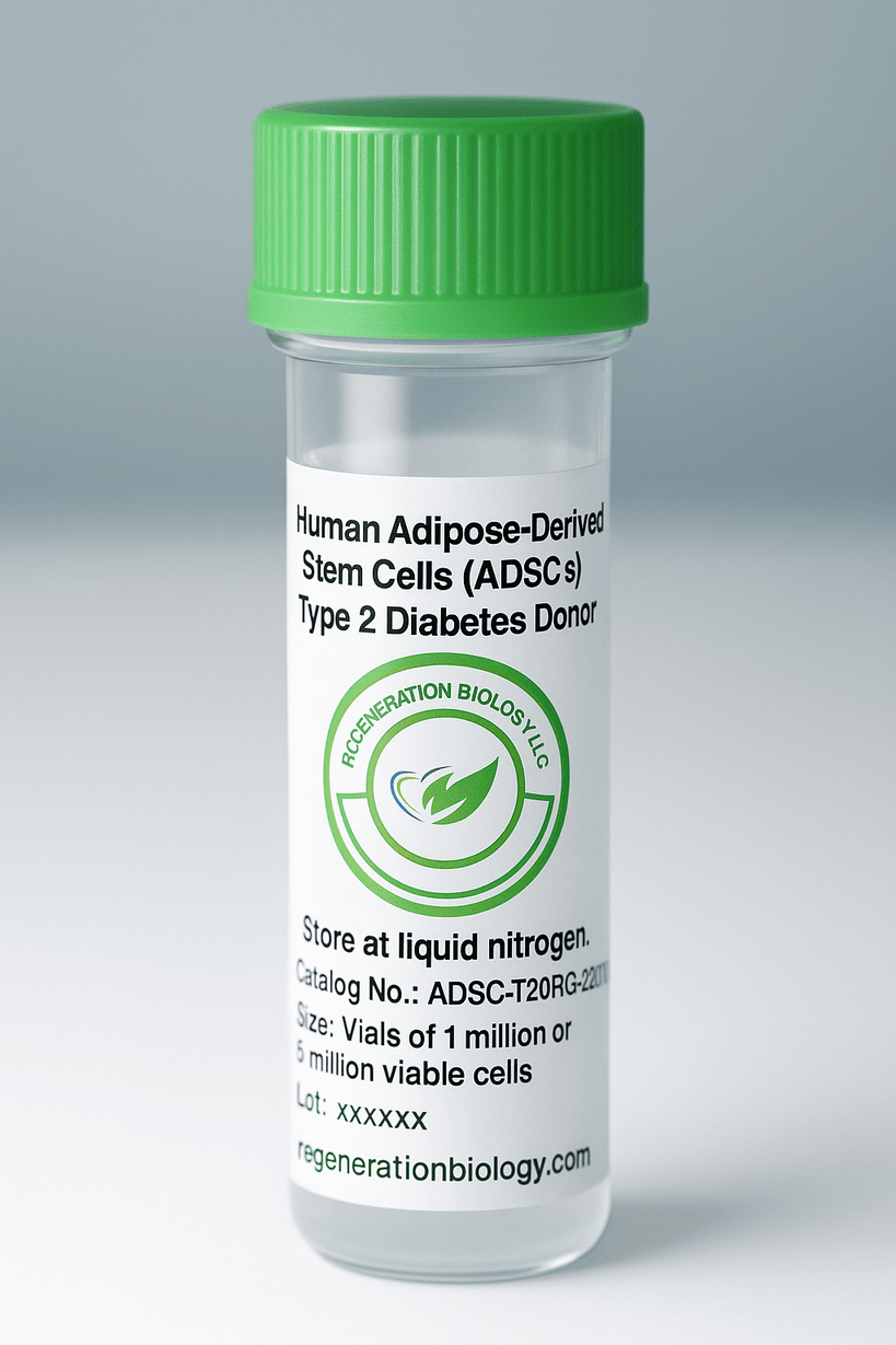 Human Adipose-Derived Stem Cells (ADSCs), Type 2 Diabetes Donor
